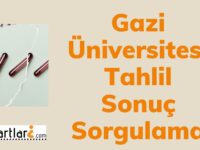 Gazi Üniversitesi Tahlil Sonuç Sorgulama |  T.c. kimlik no ile tahlil sonuçları öğrenme