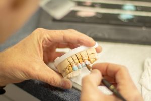 SSK Diş Protez Fiyatları | Protez diş fiyatları ne kadar?
