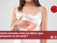 Bulantı olmadan mide içeriğinin ağza gelmesine ne ad verilir?