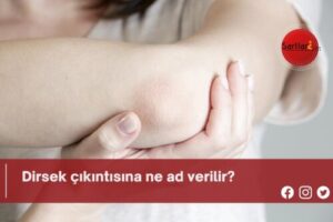 Dirsek çıkıntısına ne ad verilir?