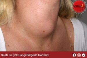 Guatr En Çok Hangi Bölgede Görülür