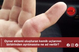 Oynar eklemi oluşturan kemik uçlarının birbirinden ayrılmasına ne ad verilir?