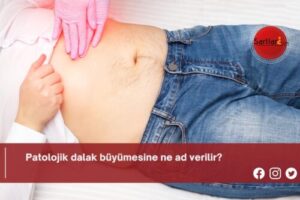 Patolojik dalak büyümesine ne ad verilir?